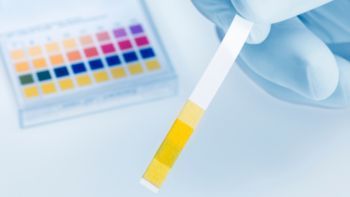 Lab technician testing pH