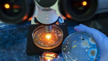 Petri dish under microscope